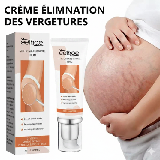 CREME ANTI VERGETURE(HOMMES -FEMMES)