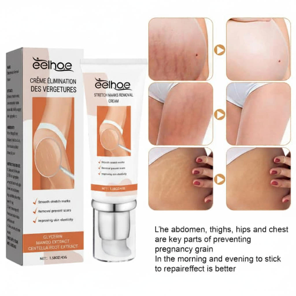 CREME ANTI VERGETURE(HOMMES -FEMMES)