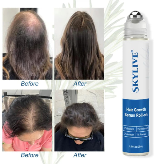 SERUM DE CROISSANCE DES CHEVEUX