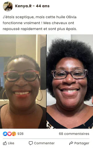 serum roll -on  pour la croissance des cheveux