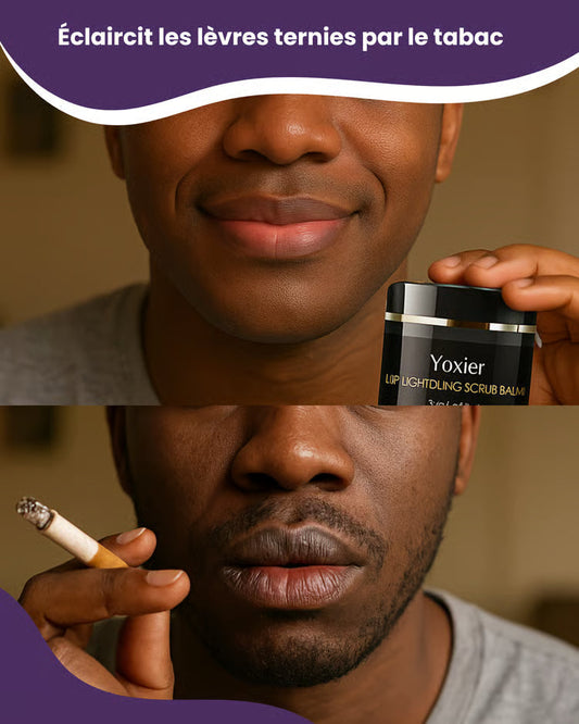 Yoxier™ | Sérum éclaircissant pour lèvres foncée ou ternies par le tabac (Satisfait ou remboursé)