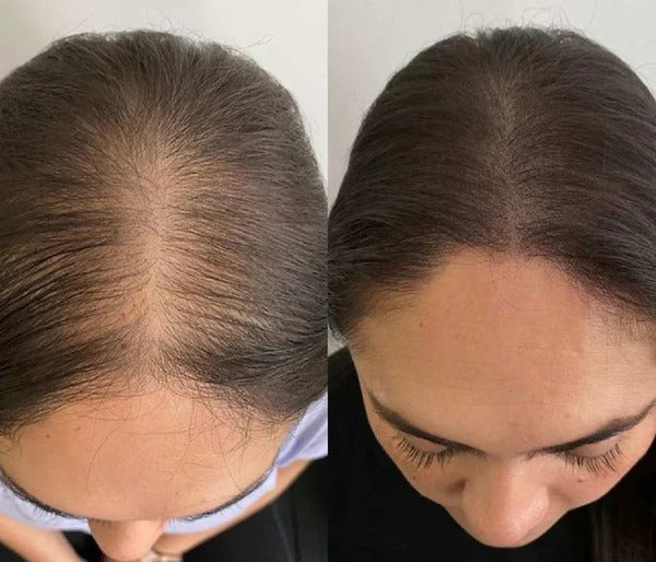 Sérum roll-on pour la croissance des cheveux